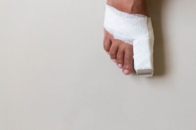 Treatment Options for Broken Toes