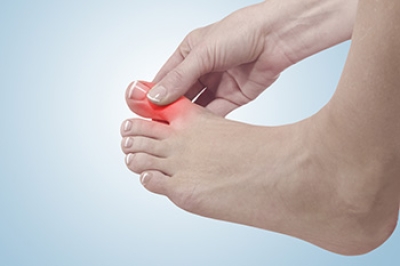 Sudden Joint Pain May Be Gout